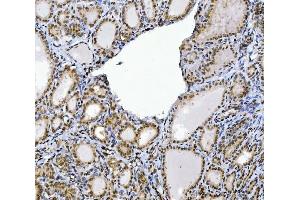 IHC analysis of CUX1 using anti-CUX1 antibody (ABIN7599103).