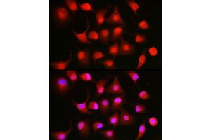 Immunofluorescence (IF) image for anti-Nuclear Factor of kappa Light Polypeptide Gene Enhancer in B-Cells 1 (NFKB1) (AA 740-964) antibody (ABIN6144571)