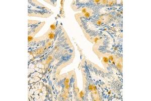Immunohistochemistry of paraffin embedded rat colon using CLCA1 (ABIN7073472) at dilution of 1:700 (400x lens)
