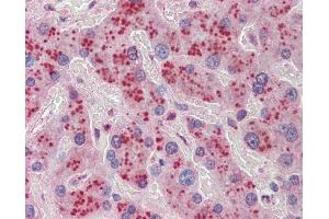 Immunohistochemistry (IHC) image for anti-NDRG Family Member 2 (NDRG2) (C-Term) antibody (ABIN2773908)