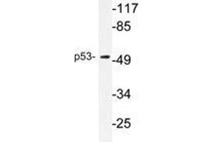 Western blot analysis of p53 antibody in extracts from COS7 cells. (p53 anticorps)