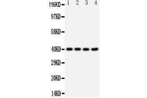 Western Blotting (WB) image for anti-Chemokine (C-X-C Motif) Receptor 1 (CXCR1) (AA 24-38), (N-Term) antibody (ABIN3042912) (CXCR1 anticorps  (N-Term))