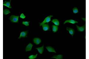 Immunofluorescence staining of A549 cells with ABIN7167931 at 1:200, counter-stained with DAPI. (ARHGAP15 anticorps  (AA 1-154))