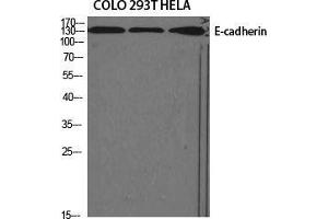 Western Blot (WB) analysis of specific cells using E-cadherin Polyclonal Antibody. (E-cadherin anticorps  (N-Term))