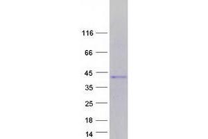 Validation with Western Blot