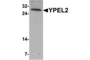 Western blot analysis of YPEL2 in HeLa cell lysate with YPEL2 antibody at 1 ug/mL. (YPEL2 anticorps  (N-Term))