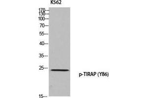 Western Blot (WB) analysis of K562 using p-TIRAP (Y86) antibody. (TIRAP anticorps  (pTyr86))