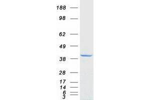 Validation with Western Blot