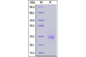 Mouse TSLP, His Tag on  under reducing (R) condition.