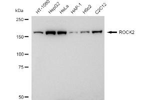 Western blotting analysis using ROCK2 antibody (ABIN7800205). (Recombinant ROCK2 anticorps)
