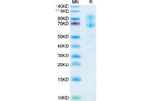 SDS-PAGE (SDS) image for IL-2 R beta & IL-2 R gamma (AA 27-240) protein (Fc Tag) (ABIN7275026)