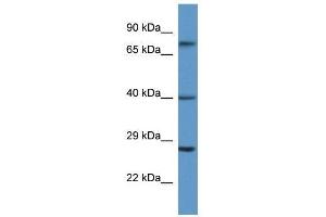 Western Blot showing AGTR2 antibody used at a concentration of 1.
