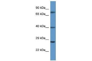 Western Blot showing AGTR2 antibody used at a concentration of 1. (Angiotensin II Type 2 Receptor anticorps  (N-Term))