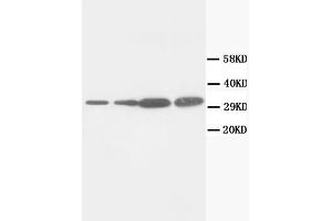 Western Blotting (WB) image for anti-Proliferating Cell Nuclear Antigen (PCNA) antibody (ABIN1108598) (PCNA anticorps)