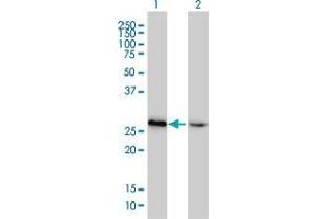 Lane 1: HMGB2 transfected lysate ( 22 KDa).