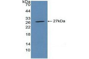 Western blot analysis of recombinant Mouse CLEC10A. (CLEC10A anticorps  (AA 69-273))