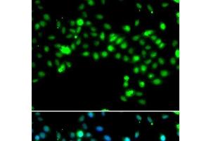 Immunofluorescence analysis of MCF-7 cells using SRSF4 Polyclonal Antibody (SRSF4 anticorps)