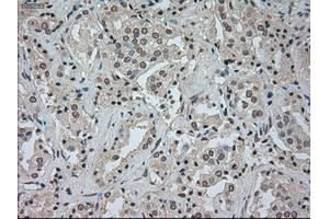 Image no. 2 for anti-Cancer/testis Antigen 1B (CTAG1B) antibody (ABIN1499899) (CTAG1B anticorps)