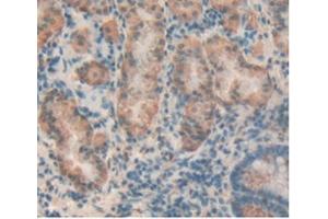 Detection of TIGIT in Human Stomach Tissue using Polyclonal Antibody to T-Cell Immunoreceptor With Ig And ITIM Domains Protein (TIGIT)