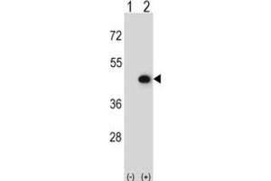 Western Blotting (WB) image for anti-Creatine Kinase, Mitochondrial 2 (Sarcomeric) (CKMT2) antibody (ABIN3002972) (CKMT2 anticorps)