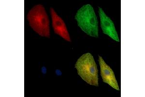 ABIN7095077 and ABIN7099133 staining  cells by IF/ICC.
