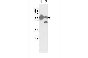 Western blot analysis of hPKM2-N491 in A2058 cell line(lane 1) and mouse brain tissue(lane 2) lysates (35ug/lane) (Pyruvate Kinase anticorps  (C-Term))