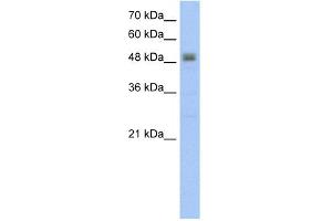 WB Suggested Anti-RSAD2 Antibody Titration:  5. (RSAD2 anticorps  (C-Term))