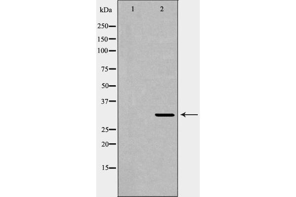 XRCC2 antibody  (C-Term)