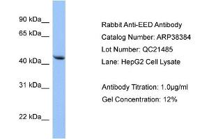 WB Suggested Anti-EED Antibody Titration: 0. (EED anticorps  (N-Term))