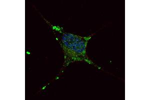 Fluorescent confocal image of SY5Y cells stained with ELP2 (C-term) antibody.
