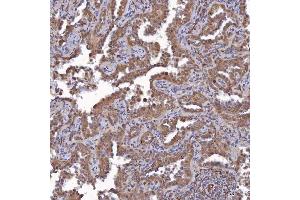 IHC analysis of SAV1 using anti-SAV1 antibody (ABIN7602478). (SAV1 anticorps  (AA 8-320))