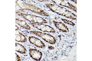 Immunohistochemistry of paraffin-embedded mouse intestin using HD Rabbit pAb (ABIN3022053, ABIN3022054, ABIN3022055 and ABIN6218586) at dilution of 1:25 (40x lens).