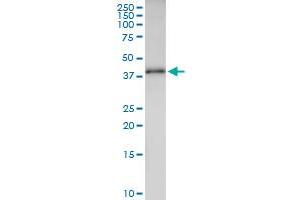 Immunoprecipitation of ANKRA2 transfected lysate using anti-ANKRA2 MaxPab rabbit polyclonal antibody and Protein A Magnetic Bead , and immunoblotted with ANKRA2 purified MaxPab mouse polyclonal antibody (B01P) .