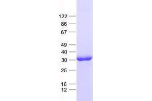 Validation with Western Blot