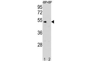 Western blot analysis of Cyclin B antibody pre-incubated without (Lane 1) and with (2) blocking peptide in K562 lysate.
