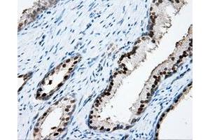 Immunohistochemistry (IHC) image for anti-Amyloid beta (A4) Precursor Protein (APP) antibody (ABIN1496878) (APP anticorps)