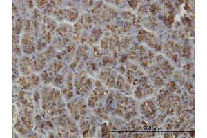 anti-Elastase 3A (ELA3A) (AA 16-270) antibody