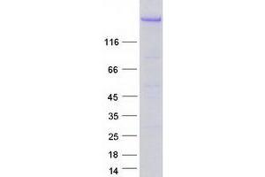 Validation with Western Blot