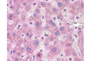ApoB antibody was used for immunohistochemistry at a concentration of 4-8 ug/ml. (APOB anticorps  (Middle Region))