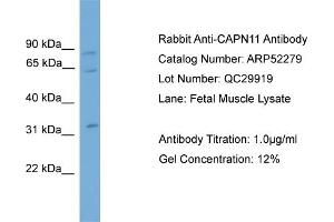WB Suggested Anti-CAPN11  Antibody Titration: 0. (CAPN11 anticorps  (N-Term))
