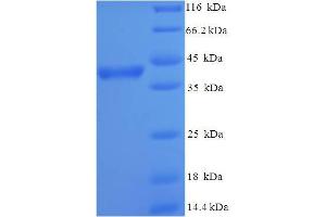 SDS-PAGE (SDS) image for Acrosomal Vesicle Protein 1 (ACRV1) (AA 22-265) protein (His-SUMO Tag) (ABIN5708993)