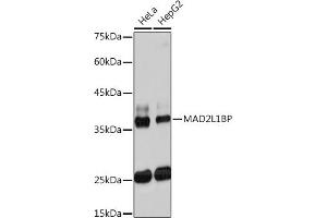 Western blot analysis of extracts of various cell lines, using ML1BP Rabbit mAb (ABIN7268357) at 1:1000 dilution. (MAD2L1BP anticorps)