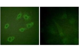 Immunofluorescence analysis of HuvEc cells, using HER3 (Phospho-Tyr1222) Antibody.