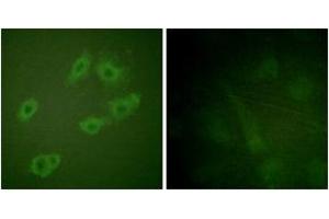 Immunofluorescence analysis of HuvEc cells, using HER3 (Phospho-Tyr1222) Antibody. (ERBB3 anticorps  (pTyr1222))