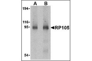 Western blot analysis of RP105 in human spleen tissue lysate with this product at (A) 0. (CD180 anticorps  (C-Term))