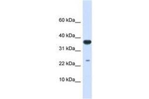 Image no. 1 for anti-Ubiquitin-Conjugating Enzyme E2D 2 (UBE2D2) (AA 36-85) antibody (ABIN6743144) (UBE2D2 anticorps  (AA 36-85))