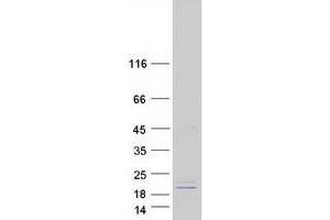 Validation with Western Blot