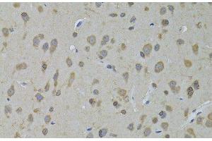 Immunohistochemistry of paraffin-embedded Rat brain using ADH5 Polyclonal Antibody at dilution of 1:100 (40x lens). (ADH5 anticorps)