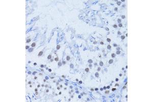 Immunohistochemistry of paraffin-embedded rat testis using PARP1 Antibody.