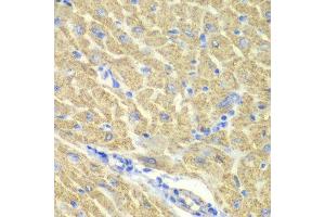 Immunohistochemistry of paraffin-embedded mouse heart using GLRX3 antibody at dilution of 1:100 (x40 lens). (GLRX3 anticorps)